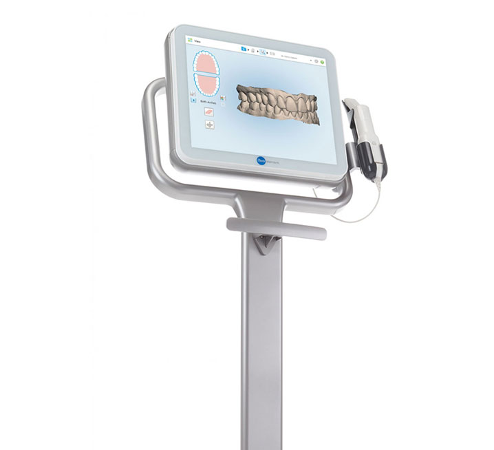 Digital orthodontic scanners