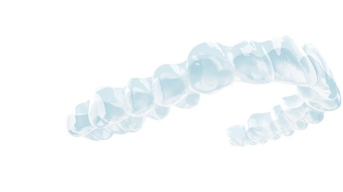 Spark aligners