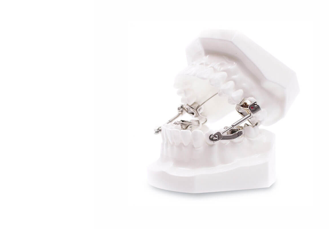 Obstructive Sleep Apnoea (OSA)