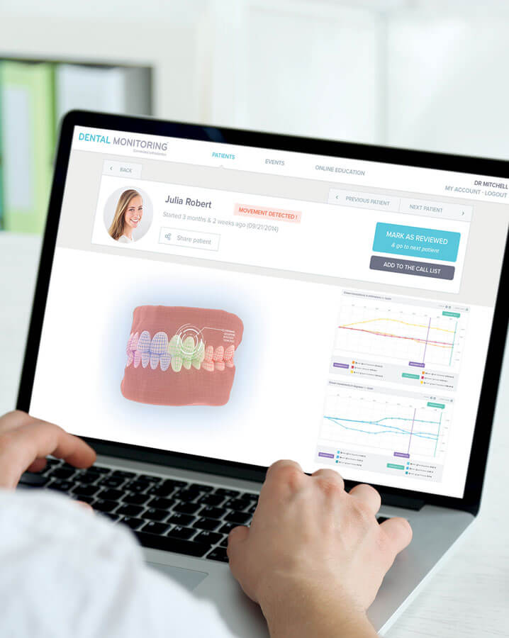 Dental Monitoring