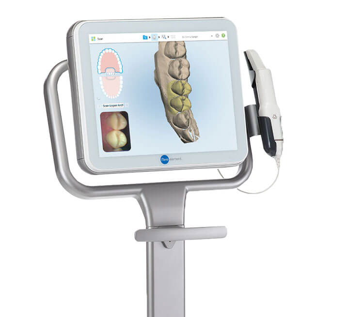 iTero: Intra oral digital scanner