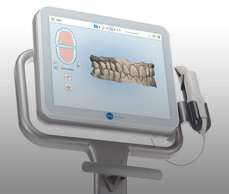 iTero: Intra oral digital scanner