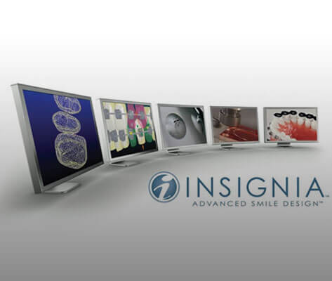 Insignia advanced smile design